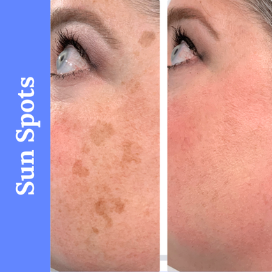 Before and after from Picoway Special at CECofNE in Portland, ME