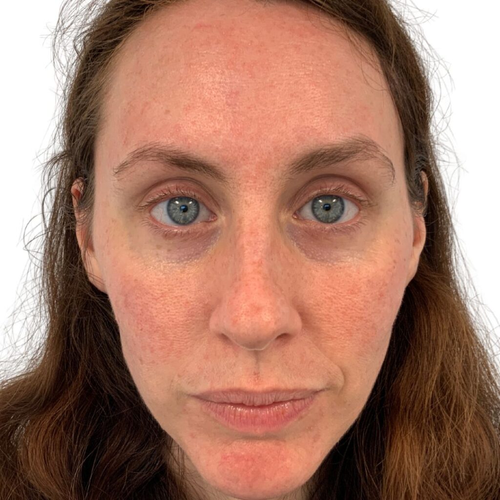bna image