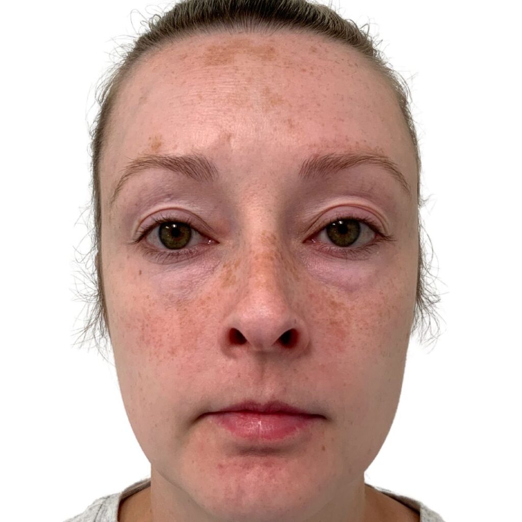bna image